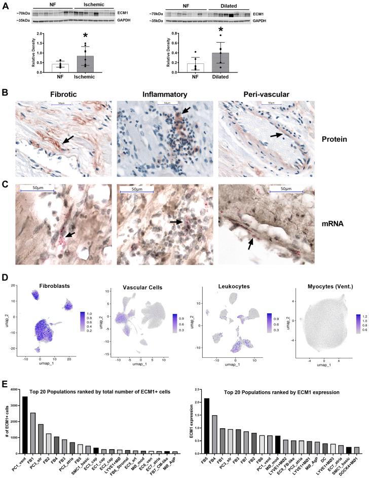 https://cdn.ncbi.nlm.nih.gov/pmc/blobs/b97b/10774582/ad99a365337d/gr1.jpg