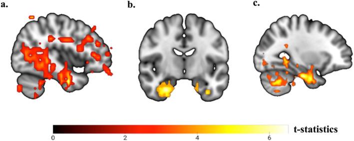 https://cdn.ncbi.nlm.nih.gov/pmc/blobs/b980/12006058/36815f0cf676/GPS-40-e70075-g005.jpg