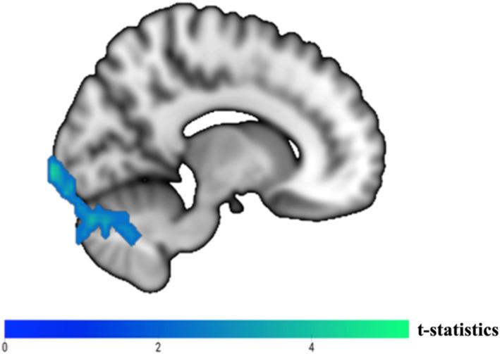 https://cdn.ncbi.nlm.nih.gov/pmc/blobs/b980/12006058/785361a3bfa8/GPS-40-e70075-g007.jpg
