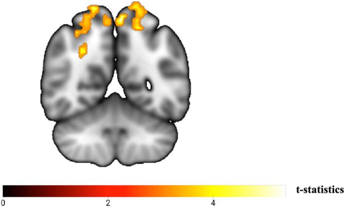 https://cdn.ncbi.nlm.nih.gov/pmc/blobs/b980/12006058/cb4b5de7c47d/GPS-40-e70075-g004.jpg