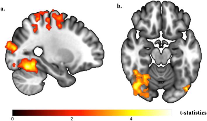 https://cdn.ncbi.nlm.nih.gov/pmc/blobs/b980/12006058/d95357df36f3/GPS-40-e70075-g006.jpg