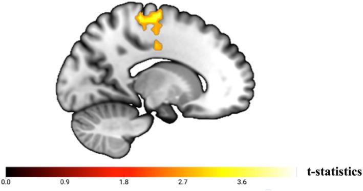 https://cdn.ncbi.nlm.nih.gov/pmc/blobs/b980/12006058/e711944fea8f/GPS-40-e70075-g002.jpg