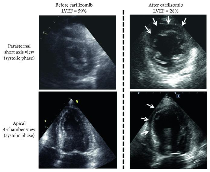 https://cdn.ncbi.nlm.nih.gov/pmc/blobs/b980/6512067/a8ca8b914104/CRIHEM2019-1816287.002.jpg