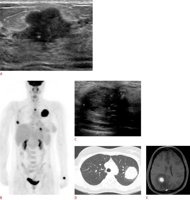 https://cdn.ncbi.nlm.nih.gov/pmc/blobs/b983/7315302/ae308f72bc61/usg-19070f11.jpg