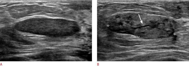 https://cdn.ncbi.nlm.nih.gov/pmc/blobs/b983/7315302/d4ca831b5973/usg-19070f9.jpg