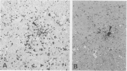 https://cdn.ncbi.nlm.nih.gov/pmc/blobs/b984/1997210/531013ea0a0b/ijexpath00006-0053-b.jpg