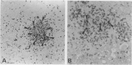 https://cdn.ncbi.nlm.nih.gov/pmc/blobs/b984/1997210/5aa91e108ba7/ijexpath00006-0053-c.jpg