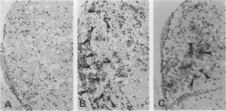 https://cdn.ncbi.nlm.nih.gov/pmc/blobs/b984/1997210/fdd5c7041b58/ijexpath00006-0052-c.jpg