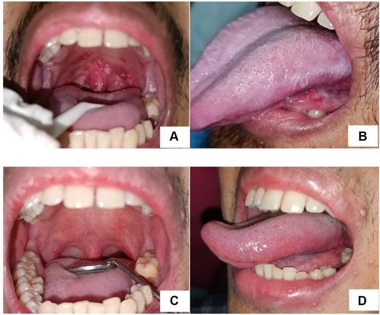 https://cdn.ncbi.nlm.nih.gov/pmc/blobs/b984/9897069/440c6220c72b/IMCRJ-16-73-g0004.jpg