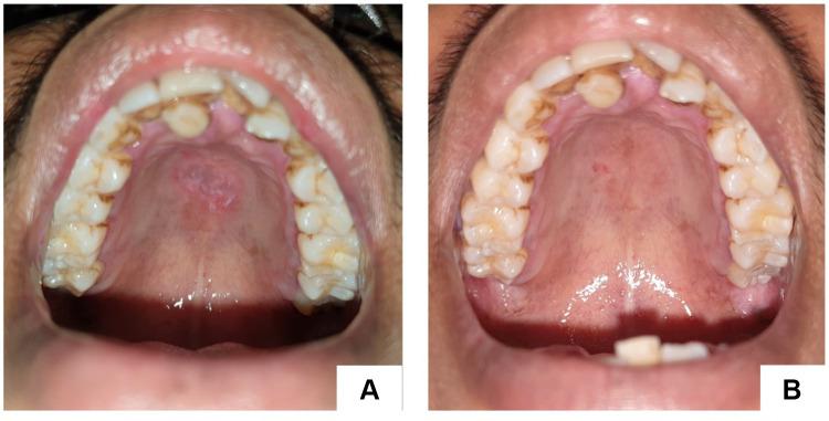 https://cdn.ncbi.nlm.nih.gov/pmc/blobs/b984/9897069/9bcfdee9331e/IMCRJ-16-73-g0001.jpg