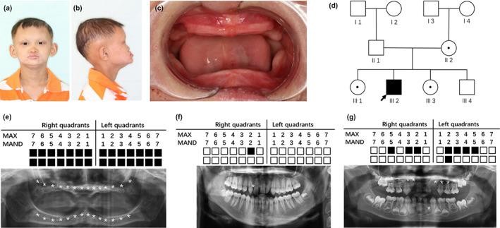 https://cdn.ncbi.nlm.nih.gov/pmc/blobs/b997/10094068/85219bcc75c0/MGG3-11-e2119-g005.jpg
