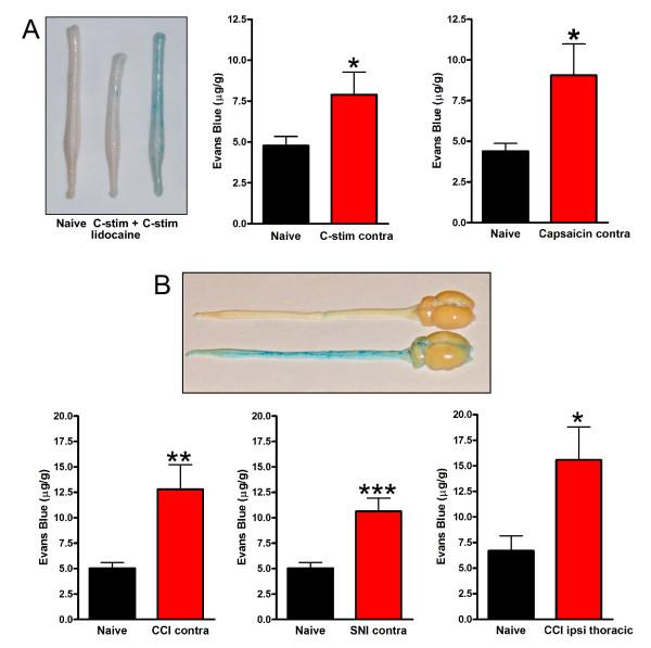 https://cdn.ncbi.nlm.nih.gov/pmc/blobs/b997/2984489/543b994fed40/1744-8069-6-74-5.jpg