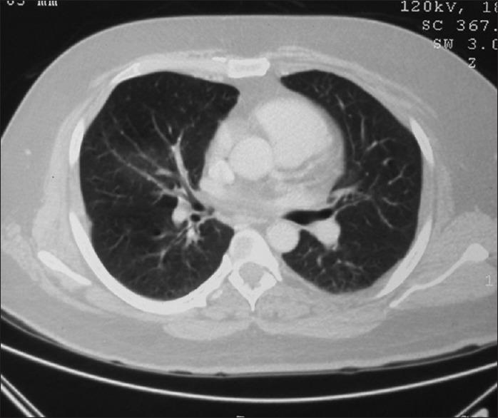https://cdn.ncbi.nlm.nih.gov/pmc/blobs/b99e/6436244/62e80c3dca7b/JFMPC-8-763-g001.jpg