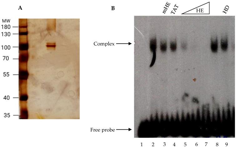 https://cdn.ncbi.nlm.nih.gov/pmc/blobs/b9a0/10253590/6b2396857148/ijms-24-09472-g005.jpg