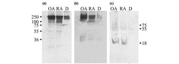 https://cdn.ncbi.nlm.nih.gov/pmc/blobs/b9a1/1526629/76f8ef5d2182/ar1947-2.jpg