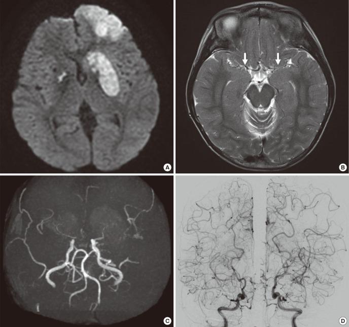 https://cdn.ncbi.nlm.nih.gov/pmc/blobs/b9a4/5639076/3a260b9aeb34/jkms-32-1896-g002.jpg