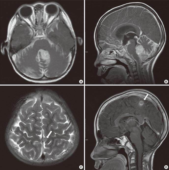 https://cdn.ncbi.nlm.nih.gov/pmc/blobs/b9a4/5639076/f39276f96ed5/jkms-32-1896-g001.jpg