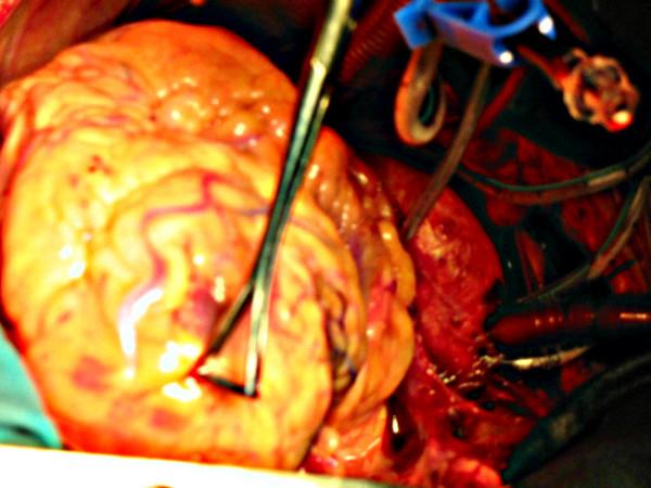 https://cdn.ncbi.nlm.nih.gov/pmc/blobs/b9a5/2104526/b05ff97404ac/1749-8090-2-42-6.jpg