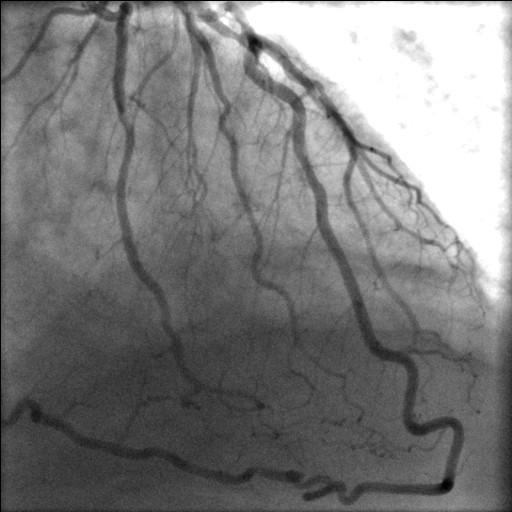 https://cdn.ncbi.nlm.nih.gov/pmc/blobs/b9a5/2104526/d28987fa43ba/1749-8090-2-42-4.jpg