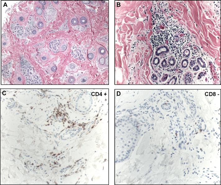 https://cdn.ncbi.nlm.nih.gov/pmc/blobs/b9a7/5993551/0584139ca56f/gr3.jpg