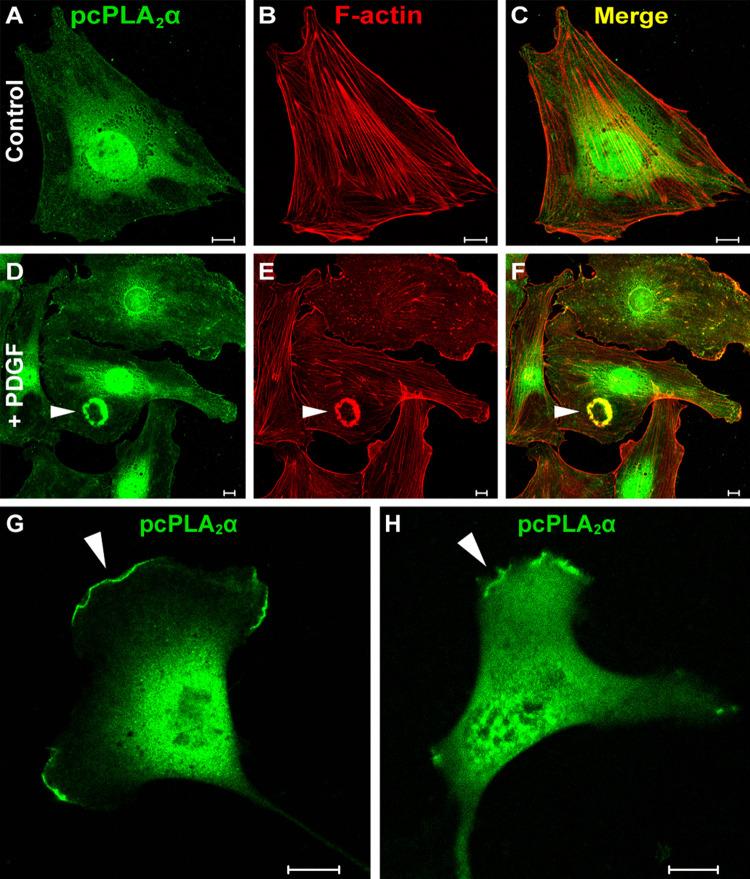 https://cdn.ncbi.nlm.nih.gov/pmc/blobs/b9ad/11115657/1d5b1fd523f7/18_2010_267_Fig5_HTML.jpg