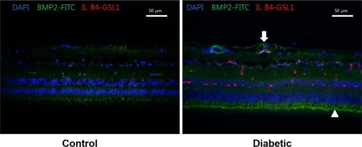 https://cdn.ncbi.nlm.nih.gov/pmc/blobs/b9b1/5645599/db4e012d2476/lar-33-216-g002.jpg
