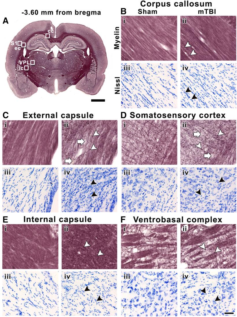 https://cdn.ncbi.nlm.nih.gov/pmc/blobs/b9b8/7307627/203df2416faa/SN-ENUJ200137F008.jpg
