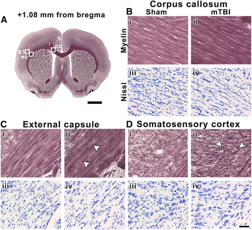 https://cdn.ncbi.nlm.nih.gov/pmc/blobs/b9b8/7307627/422ddd331926/SN-ENUJ200137F006.jpg