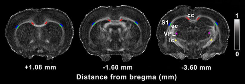 https://cdn.ncbi.nlm.nih.gov/pmc/blobs/b9b8/7307627/ee11782640b1/SN-ENUJ200137F001.jpg