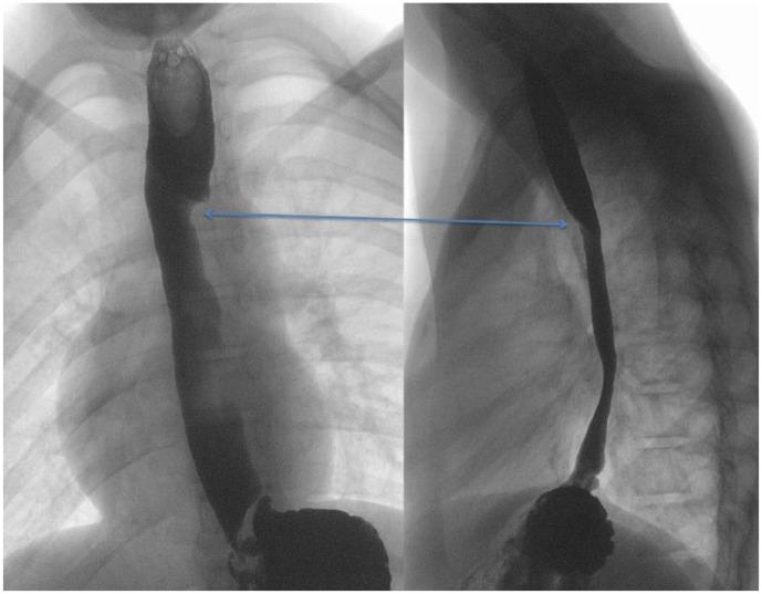 https://cdn.ncbi.nlm.nih.gov/pmc/blobs/b9ba/5846904/2f1a32a2edb1/10.1177_2333794X18762689-fig1.jpg