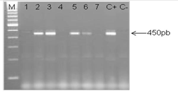 https://cdn.ncbi.nlm.nih.gov/pmc/blobs/b9be/3060847/8b4c8647d330/1750-9378-6-3-2.jpg