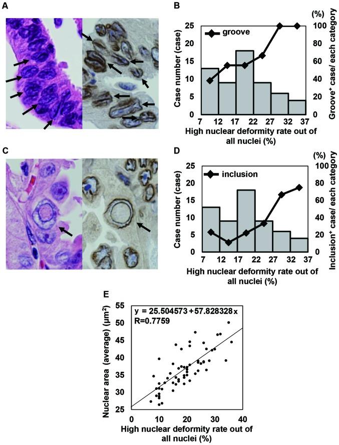 https://cdn.ncbi.nlm.nih.gov/pmc/blobs/b9c4/6278501/d75f1f1f410e/OR-41-01-0133-g04.jpg