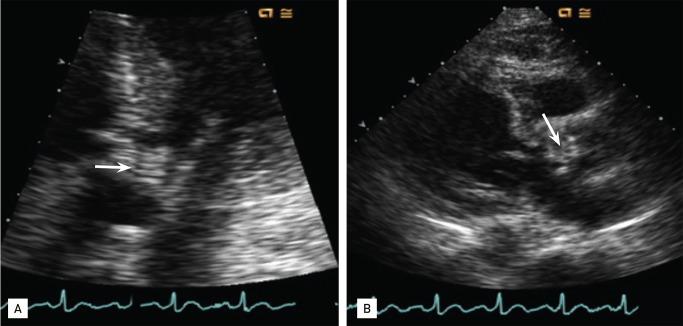https://cdn.ncbi.nlm.nih.gov/pmc/blobs/b9c8/4028533/29a09a5132a6/kjim-29-398-g001.jpg