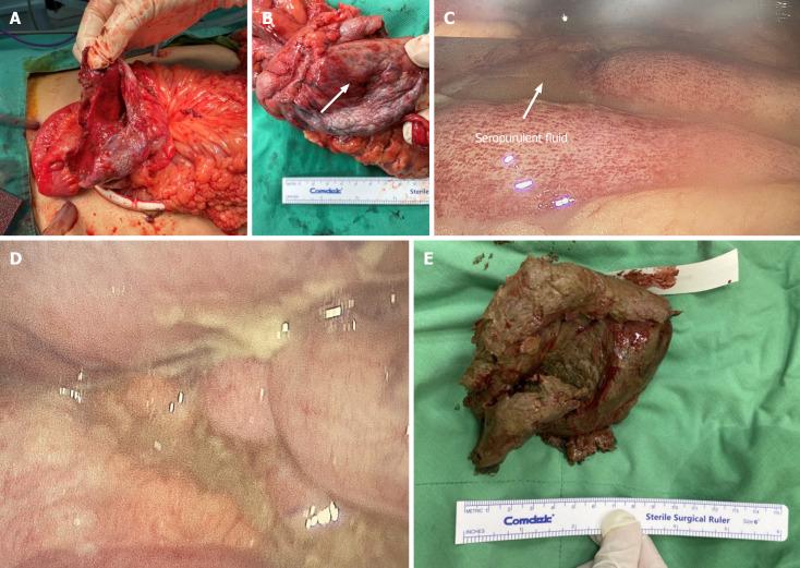 https://cdn.ncbi.nlm.nih.gov/pmc/blobs/b9d4/11056663/6356ebbd0347/WJGS-16-1189-g003.jpg