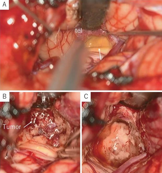 https://cdn.ncbi.nlm.nih.gov/pmc/blobs/b9d6/10635899/d76259c094cb/2188-4226-10-0303-g003.jpg