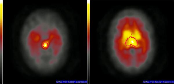 https://cdn.ncbi.nlm.nih.gov/pmc/blobs/b9d7/1891098/60717920c088/1471-244X-7-19-1.jpg
