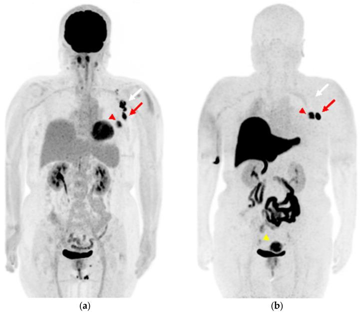 https://cdn.ncbi.nlm.nih.gov/pmc/blobs/b9d9/10252794/4d17c6fb9c96/diagnostics-13-01851-g001.jpg