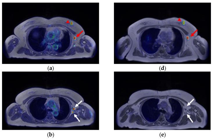 https://cdn.ncbi.nlm.nih.gov/pmc/blobs/b9d9/10252794/dfa81462c772/diagnostics-13-01851-g002a.jpg