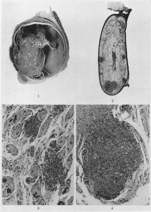 https://cdn.ncbi.nlm.nih.gov/pmc/blobs/b9da/2071181/4482e2097a15/brjcancer00493-0068-a.jpg