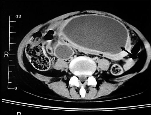 https://cdn.ncbi.nlm.nih.gov/pmc/blobs/b9dc/3075158/9a679b2108ad/crg0002-0006-f03.jpg