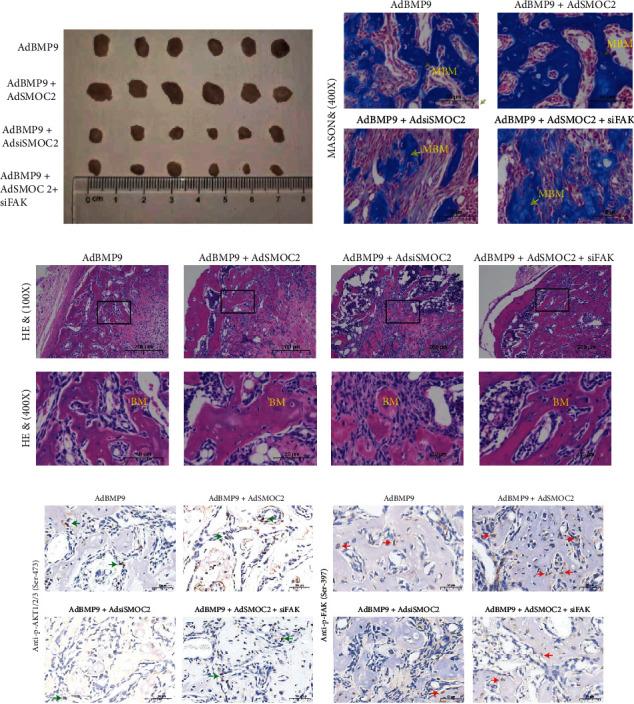 https://cdn.ncbi.nlm.nih.gov/pmc/blobs/b9dc/9870698/8d7731fd0afd/SCI2023-5915988.005.jpg