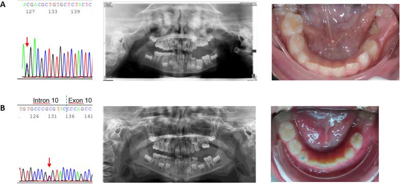 https://cdn.ncbi.nlm.nih.gov/pmc/blobs/b9de/12229487/af3a1406c292/40510_2025_570_Fig1_HTML.jpg