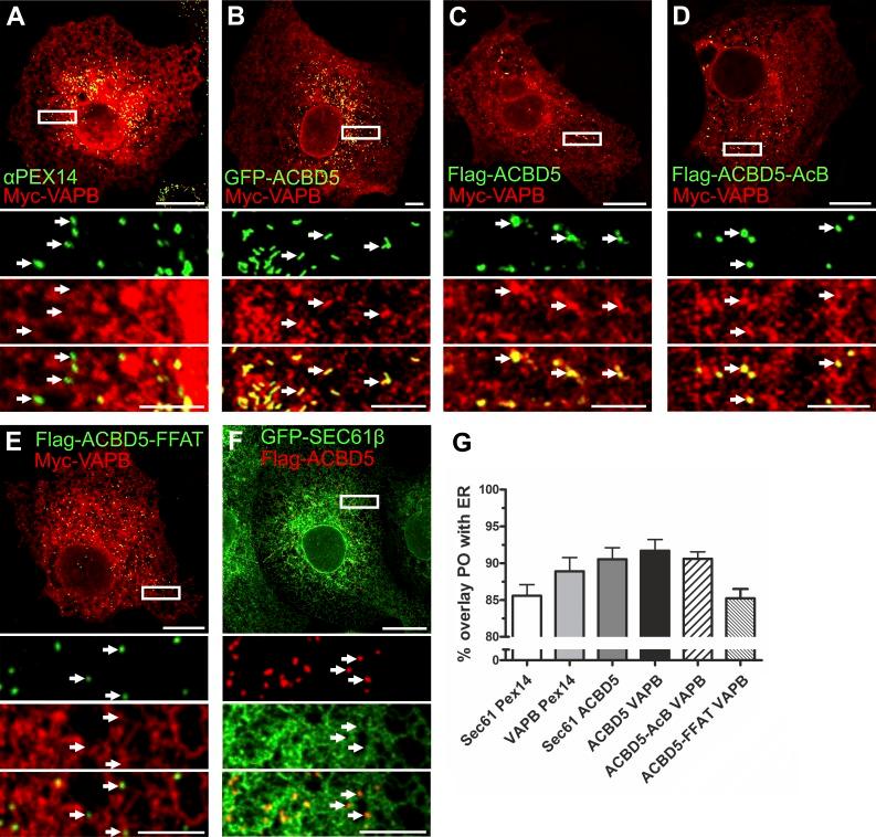 https://cdn.ncbi.nlm.nih.gov/pmc/blobs/b9e3/5294785/2b8bd15dd3b8/JCB_201607055_Fig2.jpg