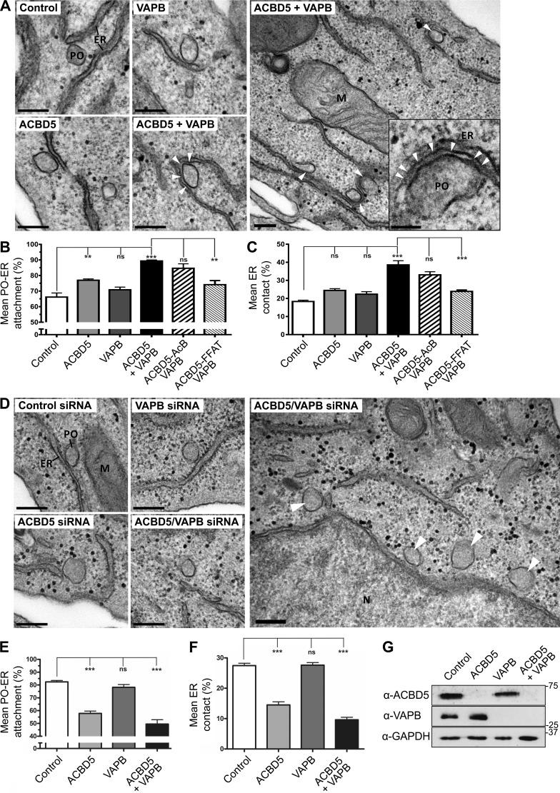 https://cdn.ncbi.nlm.nih.gov/pmc/blobs/b9e3/5294785/a25ab7699087/JCB_201607055_Fig3.jpg