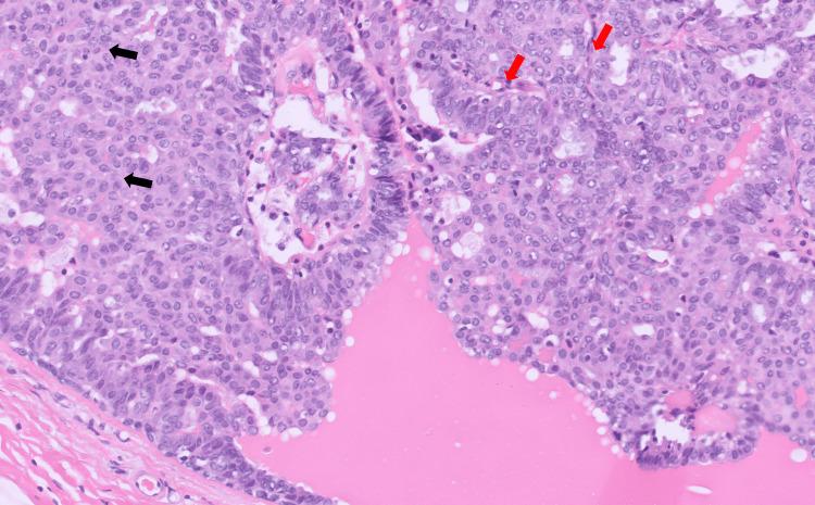 https://cdn.ncbi.nlm.nih.gov/pmc/blobs/b9e4/10869130/136ff53e584c/cureus-0016-00000052393-i03.jpg