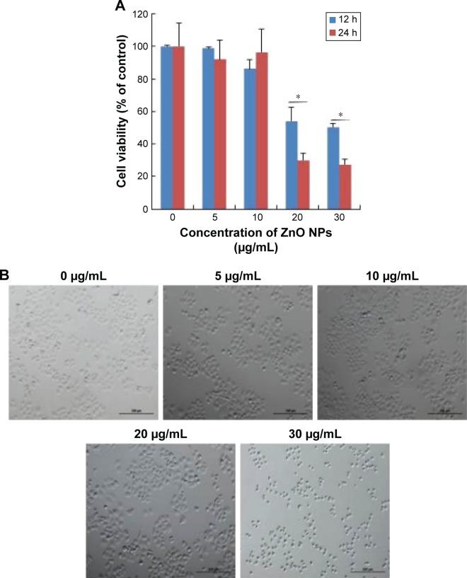 https://cdn.ncbi.nlm.nih.gov/pmc/blobs/b9e4/5592910/27b611c81ad3/ijn-12-6521Fig2.jpg