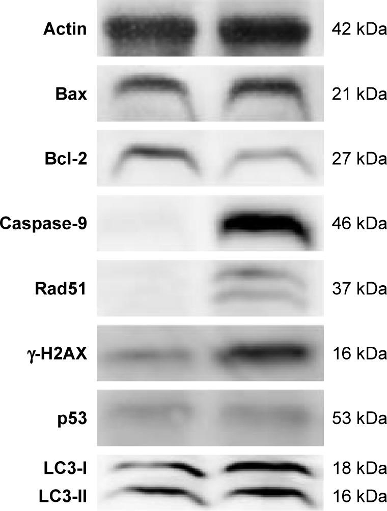 https://cdn.ncbi.nlm.nih.gov/pmc/blobs/b9e4/5592910/34e02a4d0fa3/ijn-12-6521Fig7.jpg