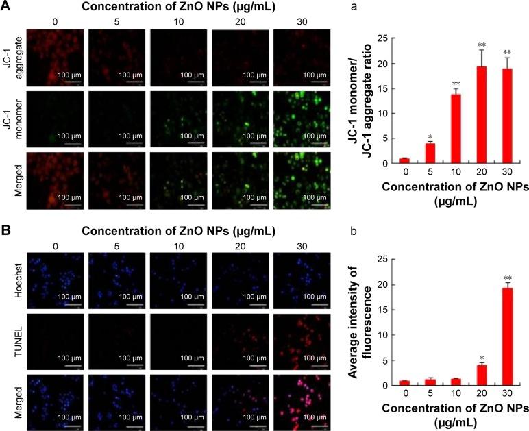 https://cdn.ncbi.nlm.nih.gov/pmc/blobs/b9e4/5592910/4fc6829ce19e/ijn-12-6521Fig4.jpg