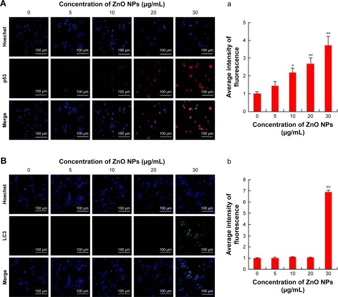 https://cdn.ncbi.nlm.nih.gov/pmc/blobs/b9e4/5592910/e0951b582a04/ijn-12-6521Fig6.jpg