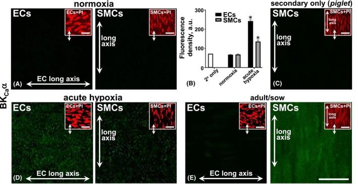 https://cdn.ncbi.nlm.nih.gov/pmc/blobs/b9e5/11926774/3d46a2aae8ad/APHA-241-e70030-g005.jpg